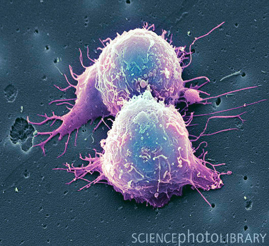 19022014 edaily uong nuoc sa chua ung thu 1