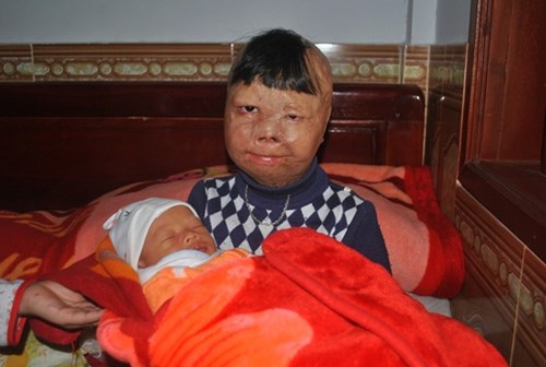 be-trai-bi-bo-tam-xang-dot-mo-uoc-thanh-bac-si