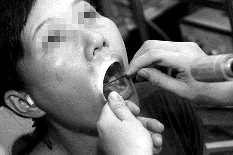 btqx- hoc xuong ca senn