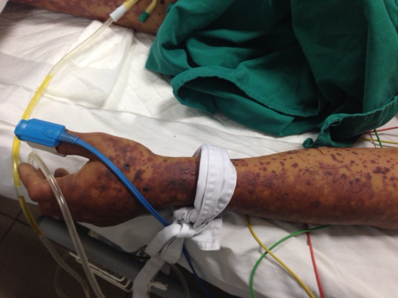 lien-cau-khuan-lon-3