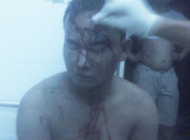 nhan-chung-ke-vu-danh-trom