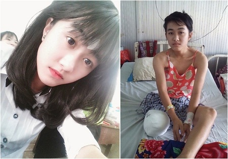 nu-sinh-bi-cua-chan-1