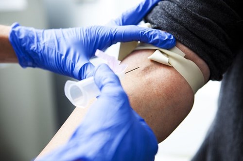 xet-nghiem-mau-co-the-doan-truoc-ung-thu-5-nam