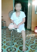 Cháu bé bị cụt chân do...bác sĩ: Trích tiền trúng số...hỗ trợ