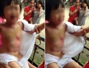 Yên Bái:  Bé gái 3 tuổi bị đốt ở Trường Mầm non, huyện Lục Yên:Trách nhiệm thuộc về ai?